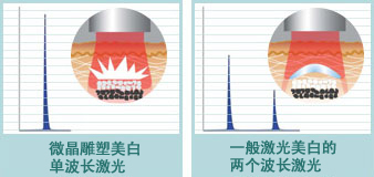 微晶雕塑美白