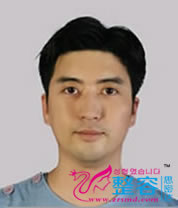 金智勋 韩国BK整形外科医院整形医生