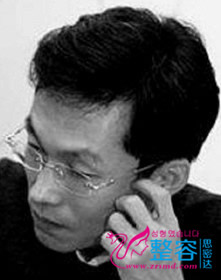 李承喆 韩国眼角整形外科医院外聘整形医生