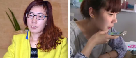 微整形日记，自体脂肪丰脸整形对比日记