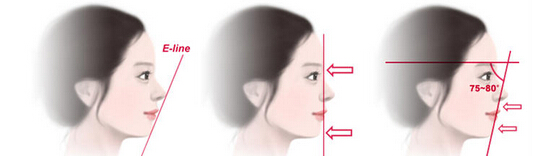 有人知道患鼻炎、鼻窦炎，能不能做鼻整形手术?